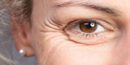 Serviço de Eliminação de marcas de expressão